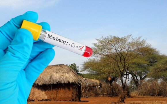 BREAKING – Ghana Confirms Cases of Infectious Marburg Virus